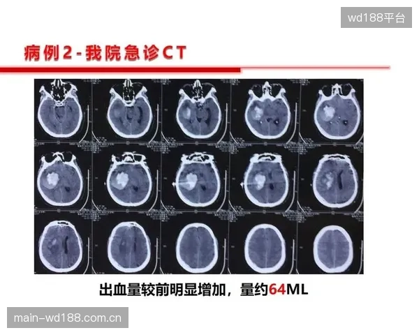 国家体育总局训练局借助神经监测协议以预警高发性运动损伤